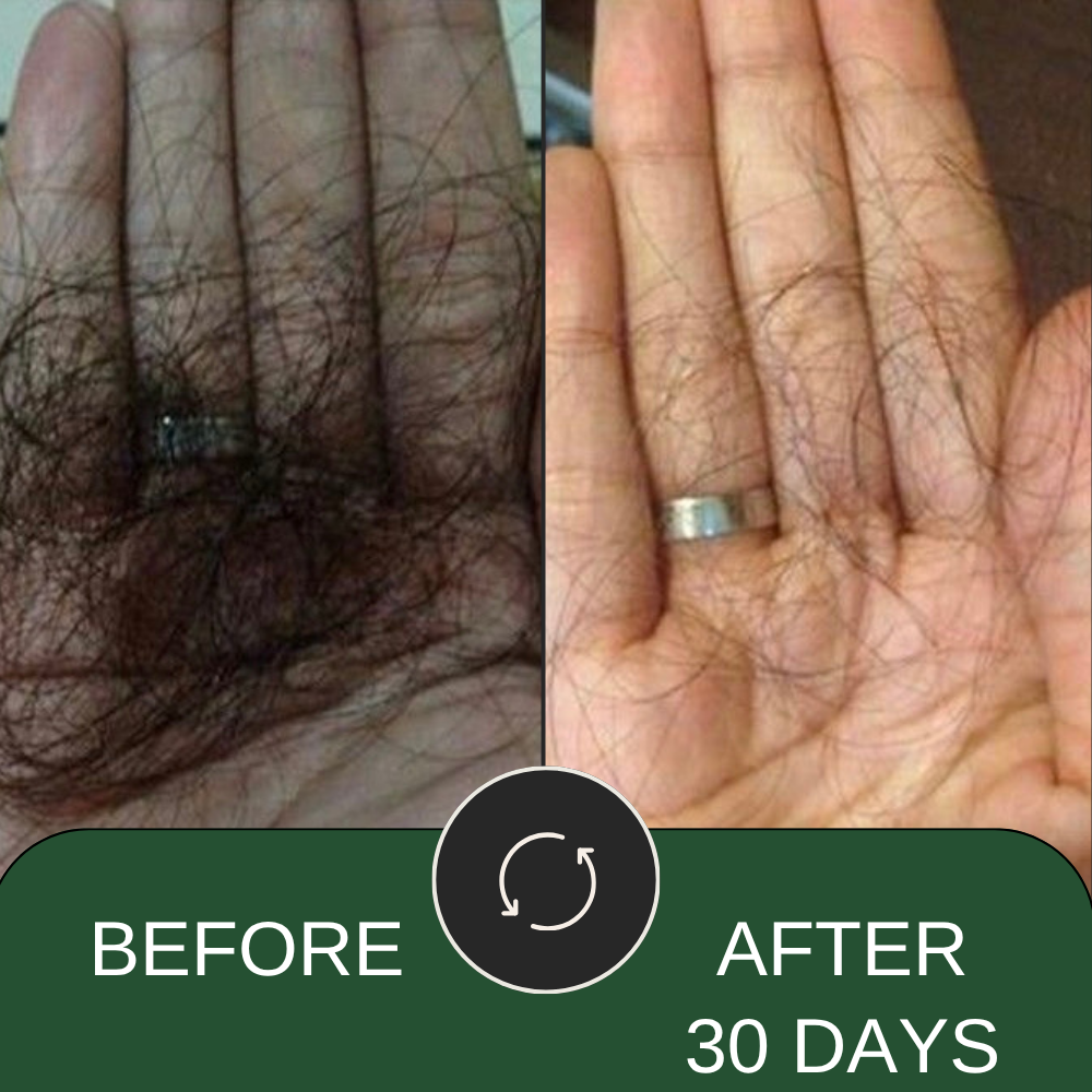 Hair Growth Supplement for Men & Women | Hair Fall Control Powder